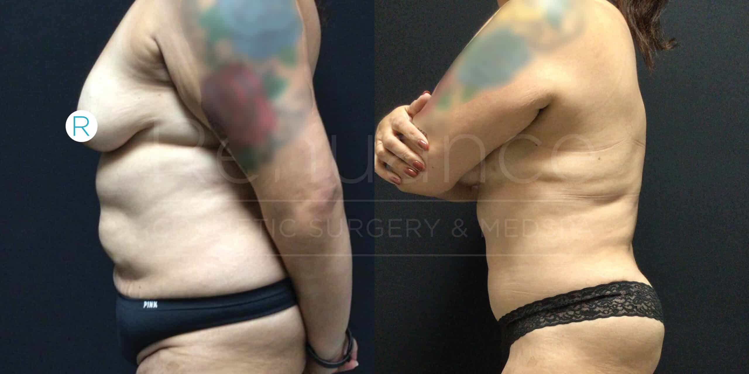 Two side-by-side images show a person before (left) and after (right) undergoing a body transformation. The person is standing sideways, revealing significant reduction in body fat. The left image shows more pronounced abdominal fat, while the right image shows a leaner midsection. The person has a colorful tattoo on their upper arm and is wearing dark underwear in both images.