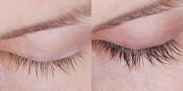 Close-up of a human eye area showing a comparison of eyelashes before and after treatment. The left side displays shorter, sparser eyelashes, while the right side shows longer, fuller eyelashes. The skin around the eyes appears smooth in both images.