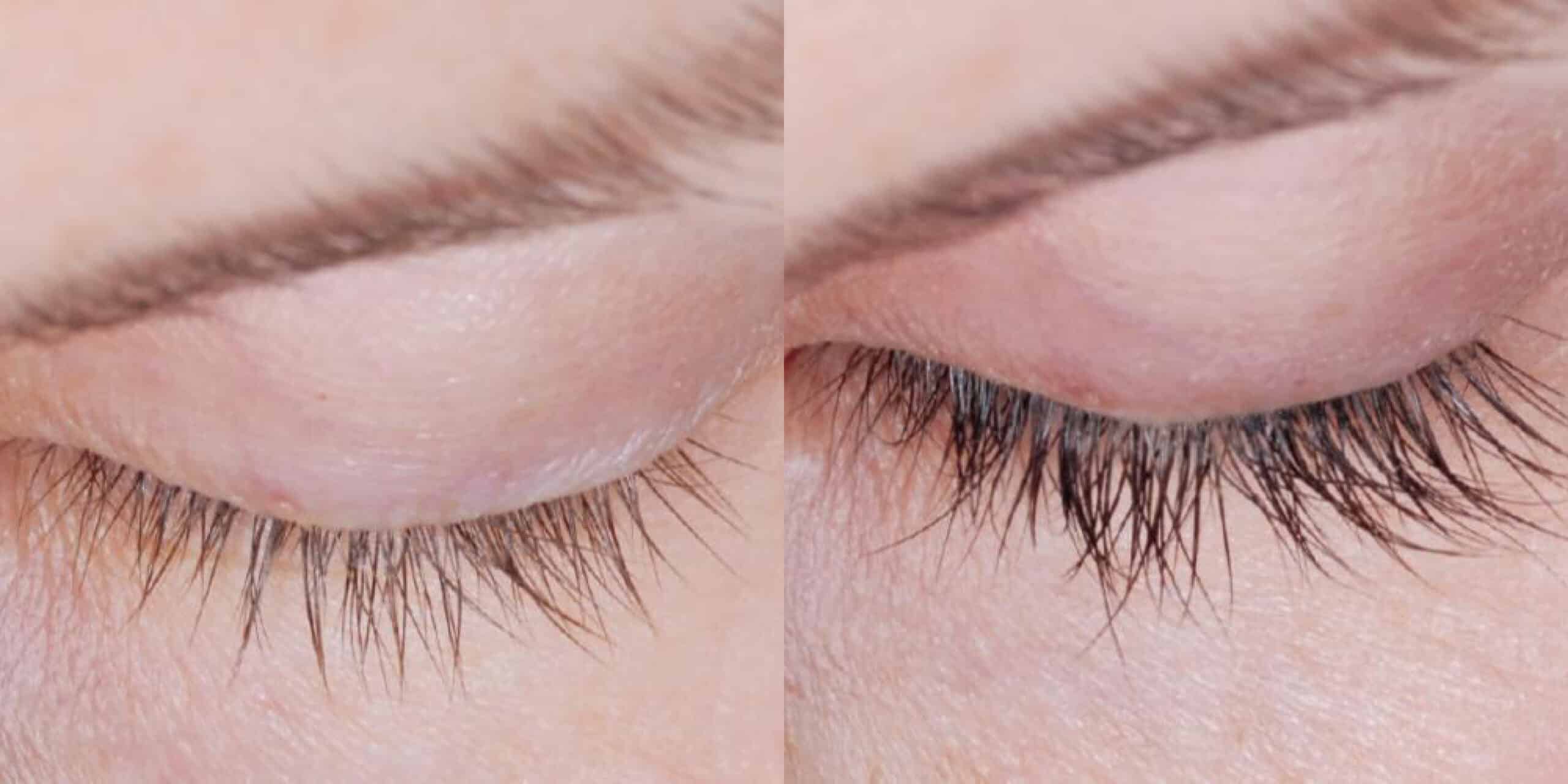 Close-up of a human eye area showing a comparison of eyelashes before and after treatment. The left side displays shorter, sparser eyelashes, while the right side shows longer, fuller eyelashes. The skin around the eyes appears smooth in both images.