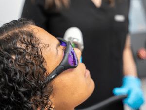 advatx for acne laser treatment