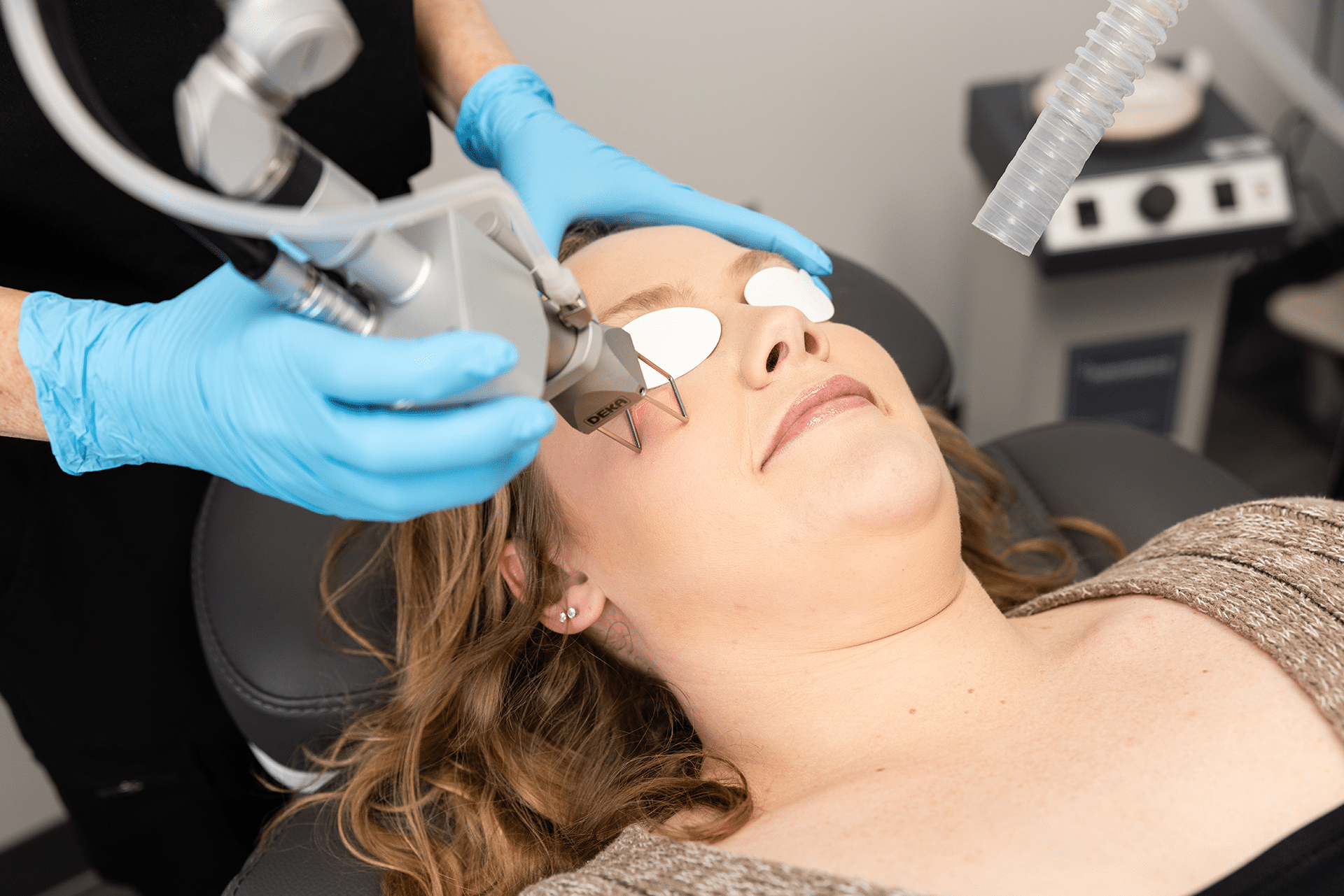 A woman getting a ipl laser treatment at Renuance in Murrieta and Rancho Bernardo