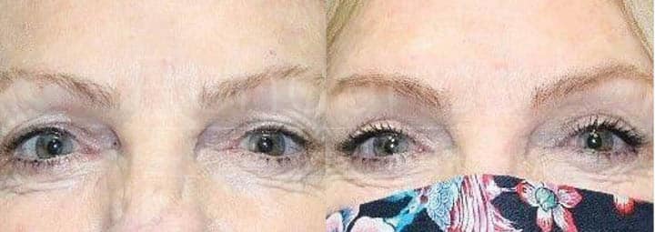 Two side-by-side photos of a woman wearing face masks. In the photo on the left, the woman is wearing a black face mask and has grayish hair. In the photo on the right, the same woman is wearing a floral-patterned face mask with colors like blue, pink, and red. She appears to have similar grayish hair.