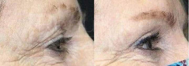 Two side-by-side photos of a woman wearing face masks. In the photo on the left, the woman is wearing a black face mask and has grayish hair. In the photo on the right, the same woman is wearing a floral-patterned face mask with colors like blue, pink, and red. She appears to have similar grayish hair.